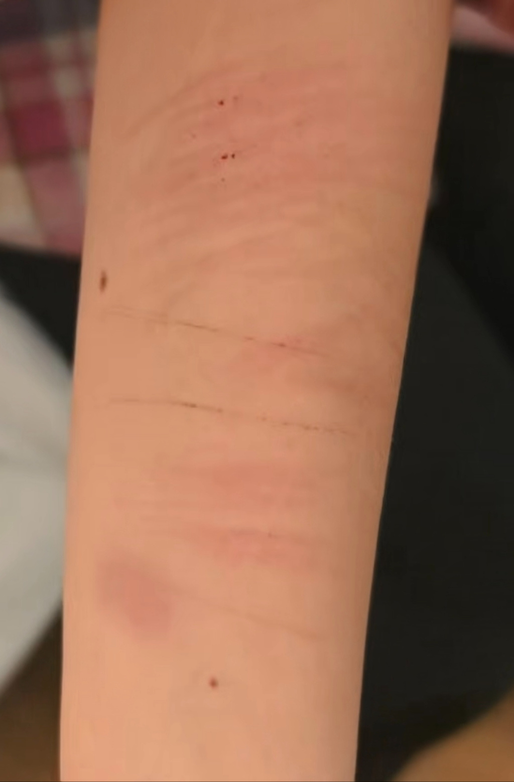 案发后,牟晓丽曾多次割腕自伤